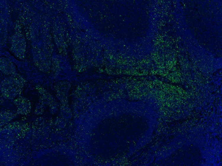 Anti-IRF5 antibody [EPR17067](AB181553)