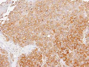 Tmed4 Antibody Ab153814  Immunohistochemistry Formalin Pfa Fixed Paraffin Embedded Sections Img34043