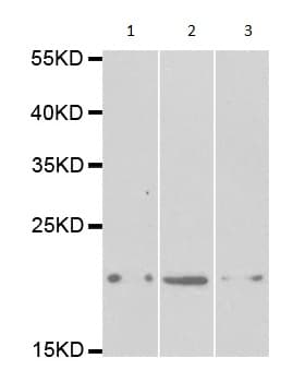 Anti-Prosurfactant Protein C antibody(AB196677)