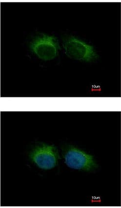 Hippi Ift57 Antibody Ab154601  Immunocytochemistry Immunofluorescence Img18404