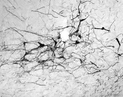 Anti-Tyrosine Hydroxylase antibody(AB76442)