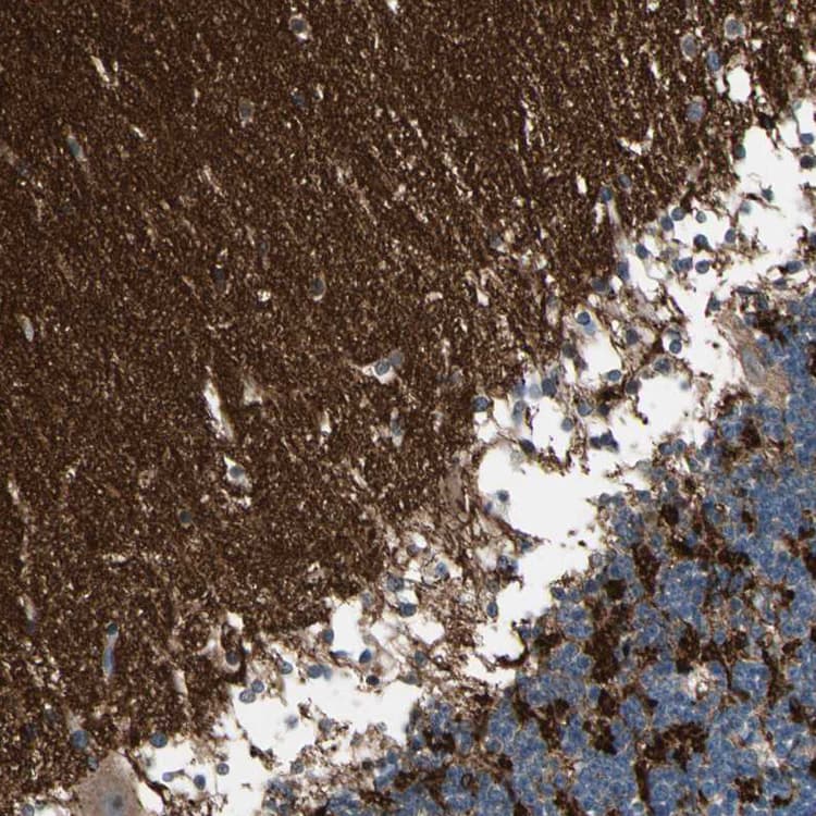 Sv2a Antibody Ab224073  Immunohistochemistry Formalin Pfa Fixed Paraffin Embedded Sections Img132443