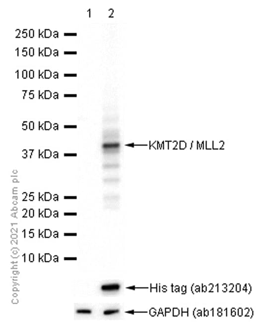 Anti-KMT2D / MLL2 antibody [EPR20604-73](AB213721)