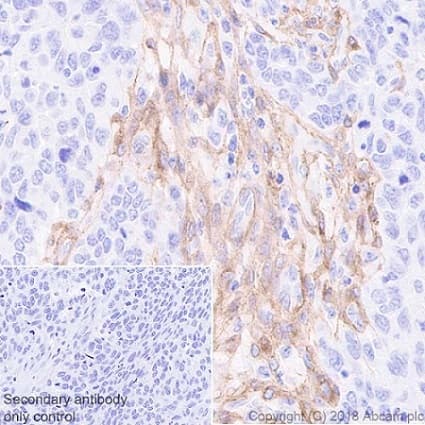 Anti-PDGFR alpha + PDGFR beta antibody [Y92] - C-terminal(AB32570)
