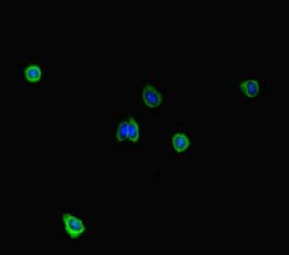 Stil Sil Antibody Ab222838  Immunocytochemistry Immunofluorescence Img52473