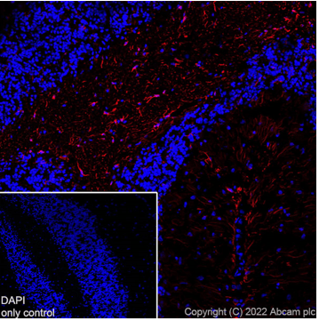 Alexa Fluor® 594 Anti-GFAP antibody [EPR1034Y](AB201732)