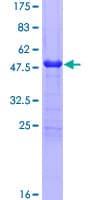 Recombinant Human SP17 protein(AB162682)