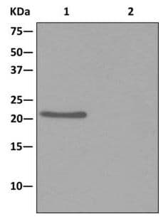 Arl15 Antibody Epr12591 Ab178425  Immunoprecipitation Img73857
