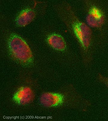Anti-alpha Lactalbumin antibody [F20.16](AB20212)
