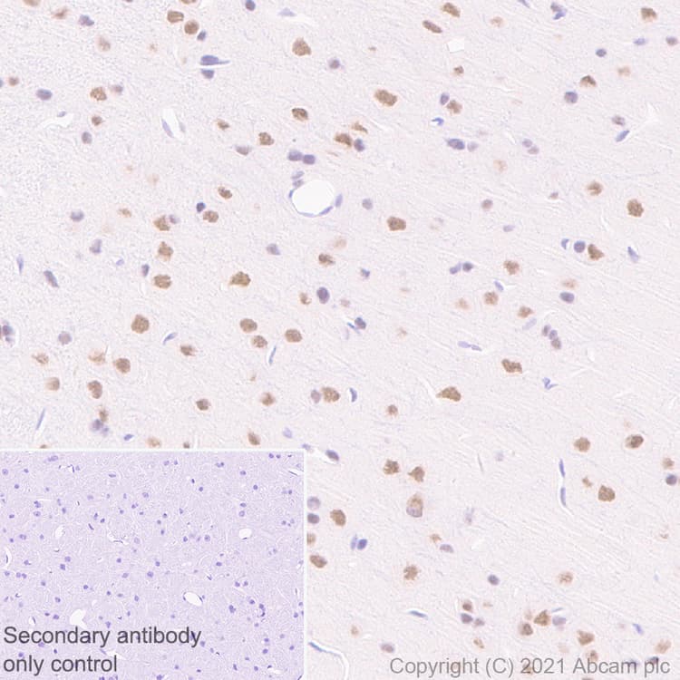 Anti-BAP1 antibody [EPR22826-65](ab255611)
