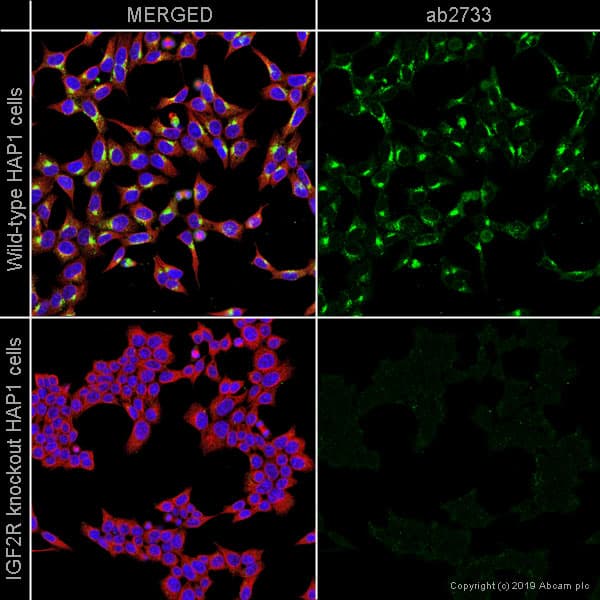 Anti-M6PR (cation independent) antibody [2G11](AB2733)