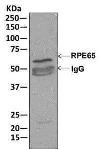 Rpe65 Antibody Epr7024n C Terminal Ab175936  Immunoprecipitation Img77729