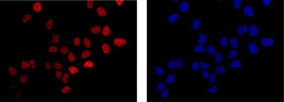 Anti-POLD1 antibody [EPR15118](AB186407)