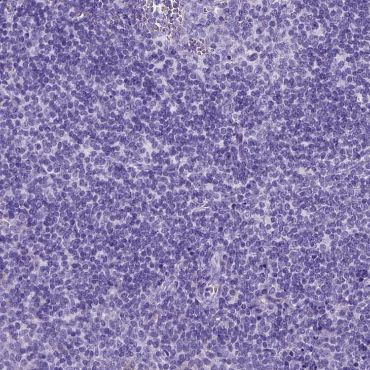 Anti-IGF2 antibody(AB262911)