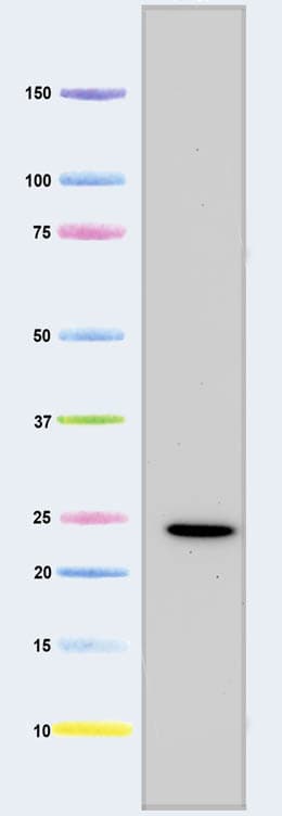 Anti-MTCO2 antibody [12C4F12](AB110258)