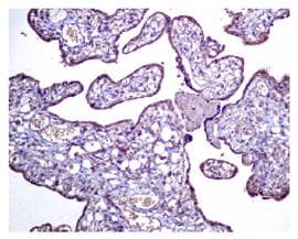 Dkk1 Antibody Epr4759 Ab109416  Immunohistochemistry Formalin Pfa Fixed Paraffin Embedded Sections Img77344
