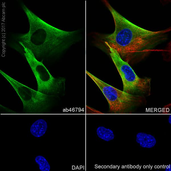 Anti-Calponin 1 antibody [EP798Y](AB46794)