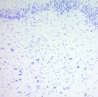 Cresyl Violet Stain Solution (0.1%)(ab246816)