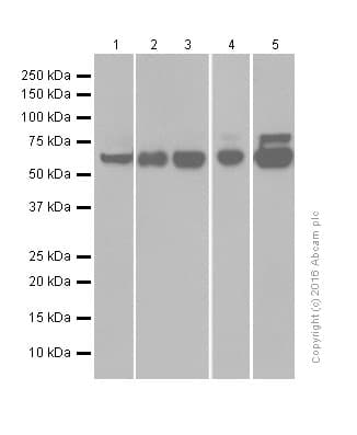 Anti-Choline Acetyltransferase antibody [EPR13024(B)](AB181023)