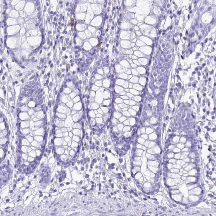 Cystatin D Antibody Ab254963  Immunohistochemistry Formalin Pfa Fixed Paraffin Embedded Sections Img32882
