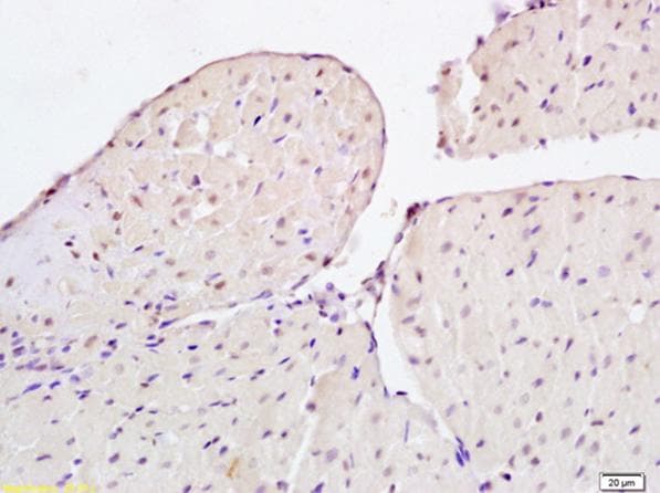 Anti-FSP27 antibody(AB213693)