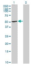 Cannabinoid Receptor I Antibody Ab167366  Western Blot Img66049