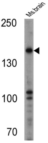 Anti-nNOS (neuronal) antibody(AB5586)