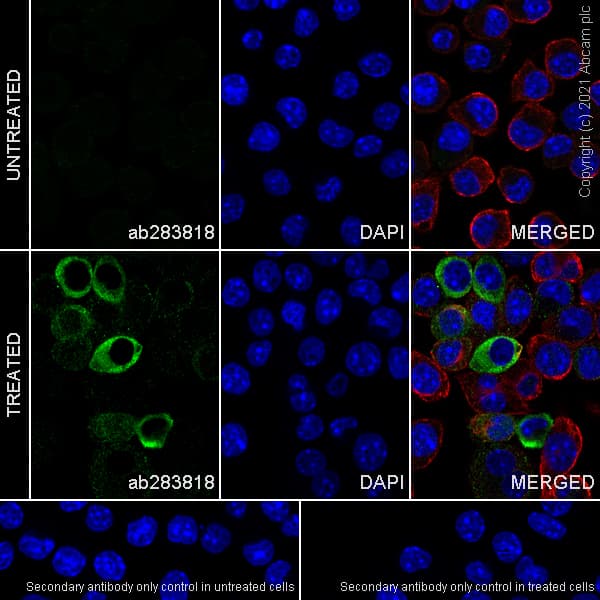 Anti-IL-1 beta antibody [RM1009](AB283818)