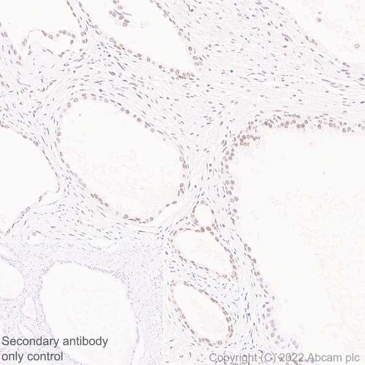 Hnrnp H Antibody Epr25302 12 Bsa And Azide Free Ab289999  Immunohistochemistry Formalin Pfa Fixed Paraffin Embedded Sections Img173783