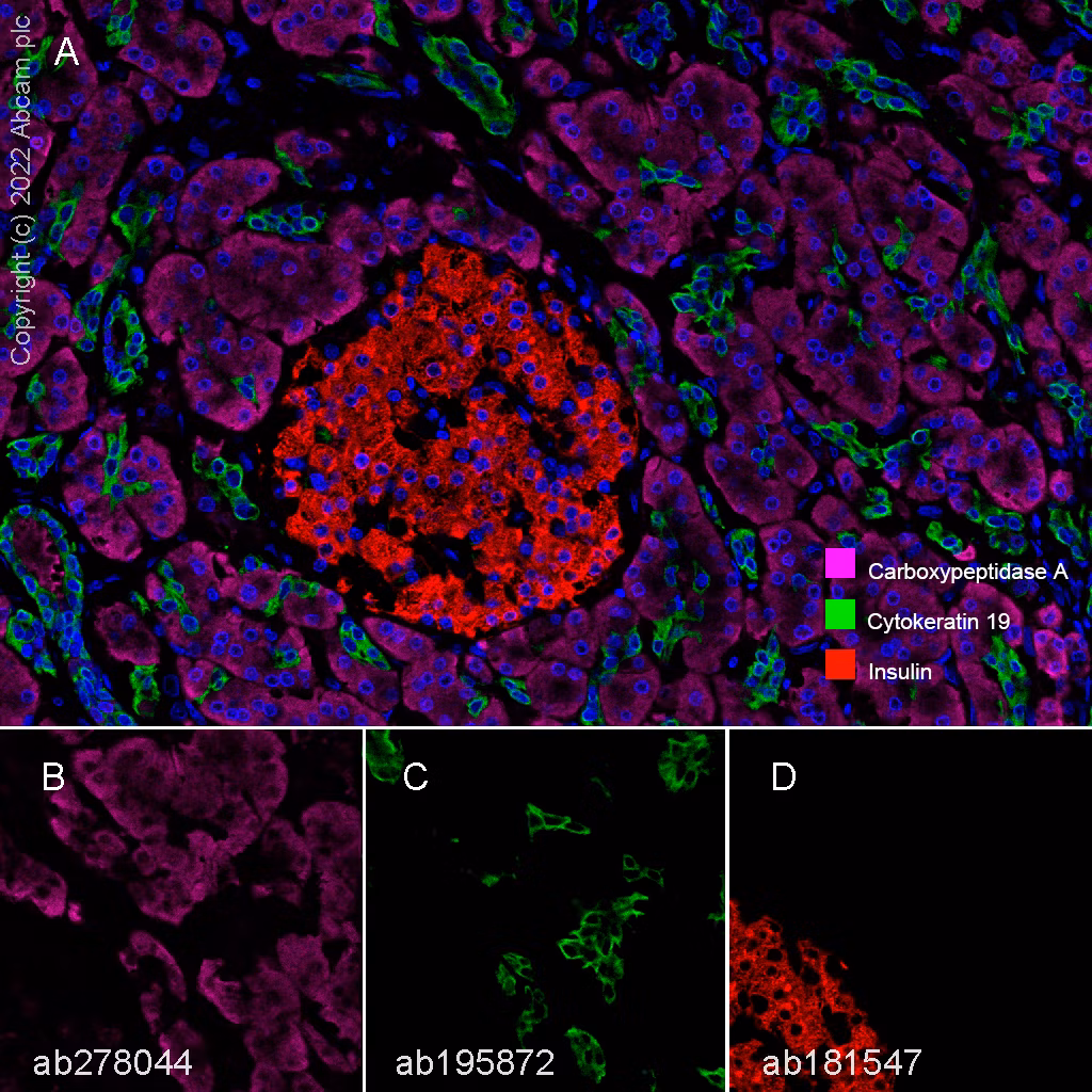 Cytokeratin 19 Antibody Ep1580y Cytoskeleton Marker Ab52625 Multiplex Immunohistochemistry Img416093