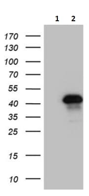 Znf558 Antibody Oti2c4 Ab236428  Western Blot Img161063