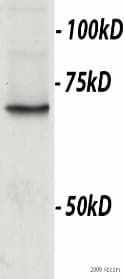 Anti-TBR2 / Eomes antibody(AB23345)