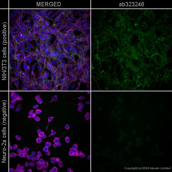 Rabbit Monoclonal H26 10 Human Igg1 H L Alexa Fluor 488 Ab200622  Immunocytochemistry Immunofluorescence Img440859