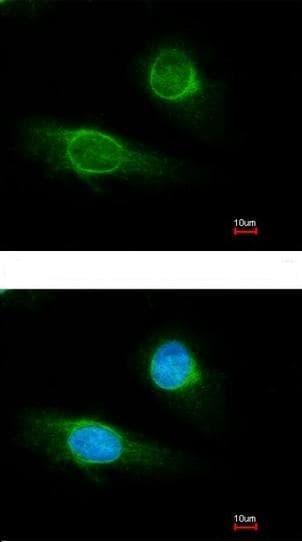 Anti-Fibrinogen gamma chain antibody(AB137728)