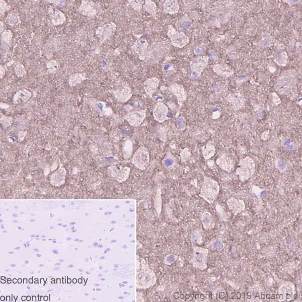 Anti-beta Synuclein antibody [EP1537Y] - BSA and Azide free(AB221908)
