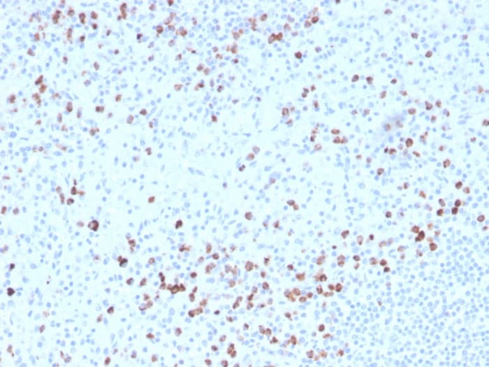 Biotin Granzyme B Antibody Gzmb 3014 Ab271818  Immunohistochemistry Formalin Pfa Fixed Paraffin Embedded Sections Img54696