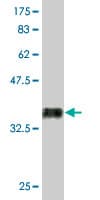 Anti-RUNX2 antibody [2B9](AB76956)