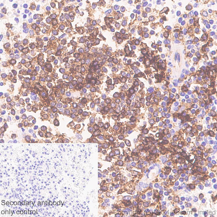 Anti-HLA DR + DP + DQ antibody [CR3/43](ab7856)