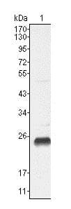 Anti-Lin28A antibody [6D1F9](AB76369)