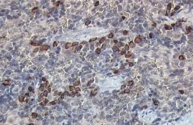 Beta 2 Microglobulin Antibody Ab227261  Immunohistochemistry Formalin Pfa Fixed Paraffin Embedded Sections Img450485