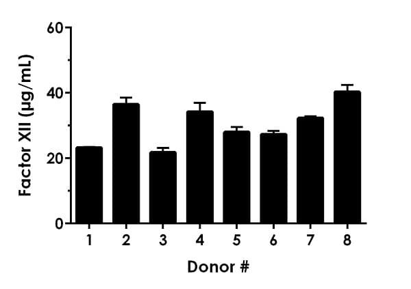 Human Factor XII ELISA Kit(AB192144)