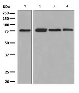 Anti-FACL4 antibody [EPR8640](AB155282)