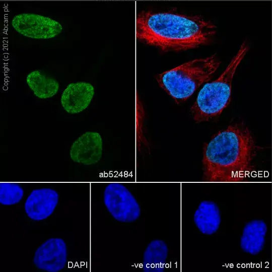 Goat Anti-Rabbit IgG H&L (Alexa Fluor® 594)(AB150080)