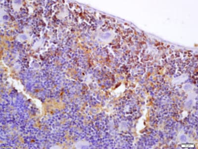 S100p Binding Protein Antibody Ab203689  Immunohistochemistry Formalin Pfa Fixed Paraffin Embedded Sections Img96730