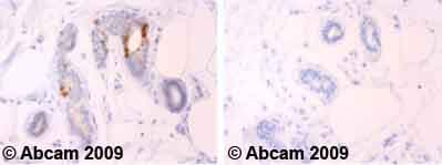 Cdk1 Antibody A17 Ab18  Immunohistochemistry Formalin Pfa Fixed Paraffin Embedded Sections Img118164