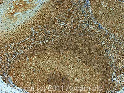 Mtr4 Antibody Ab70551  Immunohistochemistry Formalin Pfa Fixed Paraffin Embedded Sections Img65676