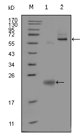 Anti-Pea3 antibody [1A2G3](ab70425)