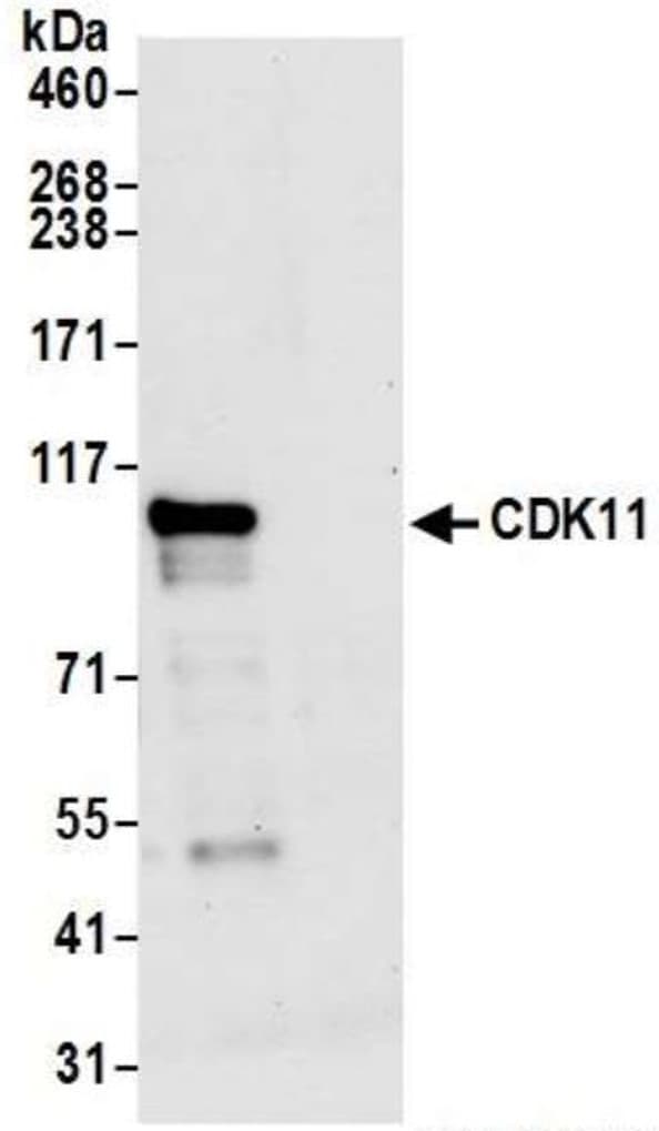 Cdk11 Cdc2l2 Cdk11a Antibody Ab19393  Immunoprecipitation Img178227