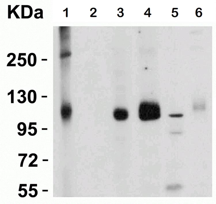 Anti-ACE2 antibody(AB15348)