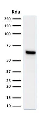 Anti-Estrogen Receptor antibody [ESR1/1935](AB237995)